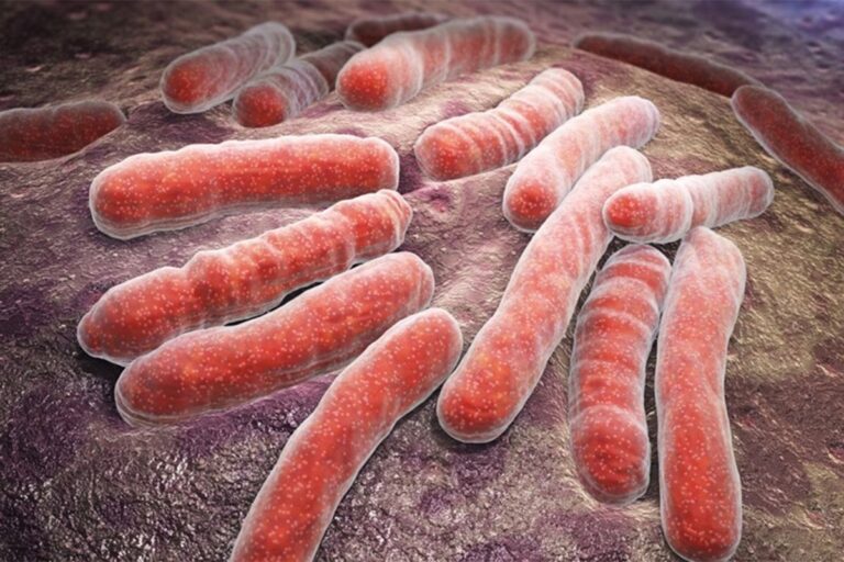 Šta je meningokokna sepsa od koje je preminulo dijete iz Visokog Šta je meningokokna sepsa od koje je preminulo dijete iz Visokog