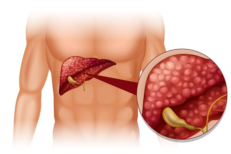 Doktor tvrdi: “Ako ovo jedete, vaša jetra je puna otrova”